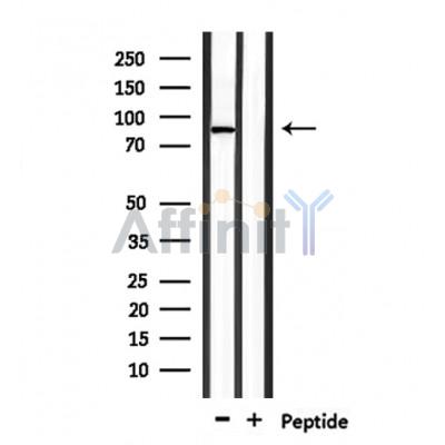 TMC7 Antibody - Western blot analysis of extracts from mouse brain, using TMC7 Antibody.