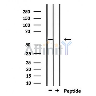 USP17L Antibody - Western blot analysis of extracts from mouse brain, using USP17L Antibody.
