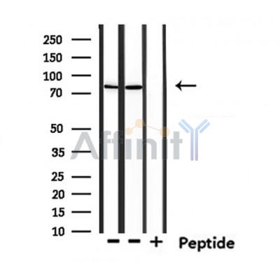 USP51 Antibody - Western blot analysis of extracts from mouse muscle and mouse brain, using USP51 Antibody.
