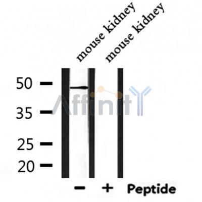 Rabr Antibody - Western blot analysis of extracts from mouse kidney, using Rabr Antibody.