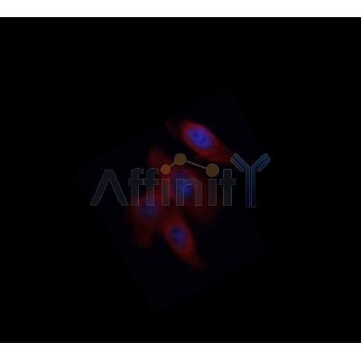 IL1 beta Antibody - AF5103 staining murine bone marrow-derived macrophages by ICC/IF.