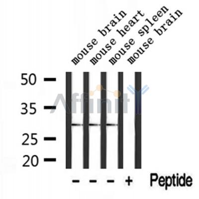 TSSK3 Antibody - Western blot analysis of extracts from mouse brain and mouse heart and mouse spleen, using TSSK3 Antibody.