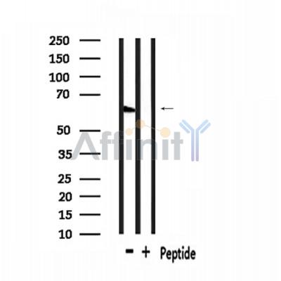 GPR148 Antibody - Western blot analysis of extracts from rat muscle, using GPR148 Antibody.