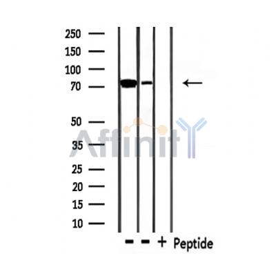 MAP3K3 Antibody - Western blot analysis of extracts from 293 and Hela , using MAP3K3 Antibody.
