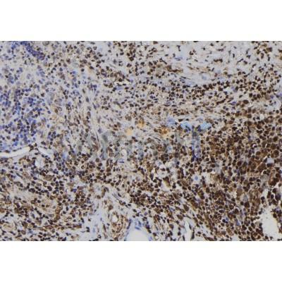 CD164L2 Antibody - DF10023 at 1/100 staining Human spleen tissue by IHC-P.