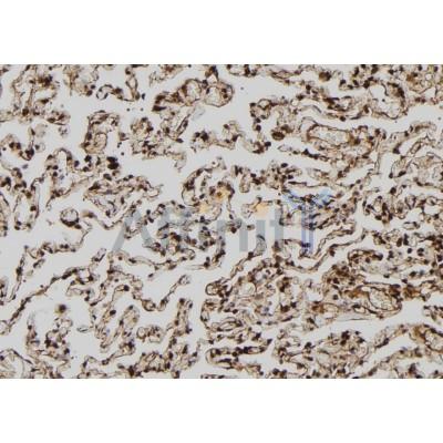 MAGEA8 Antibody - DF10032 at 1/100 staining Human lung tissue by IHC-P.
