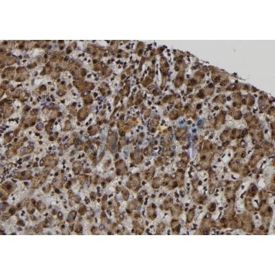 MAGEA12 Antibody - DF10034 at 1/100 staining Human liver tissue by IHC-P.