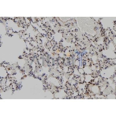 MAGD2 Antibody - DF10040 at 1/100 staining Rat lung tissue by IHC-P.