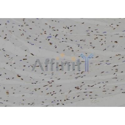 HEN2 Antibody - DF10046 at 1/100 staining Mouse heart tissue by IHC-P.