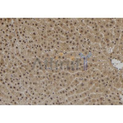 ZNF839 Antibody - DF10057 at 1/100 staining Rat liver tissue by IHC-P.