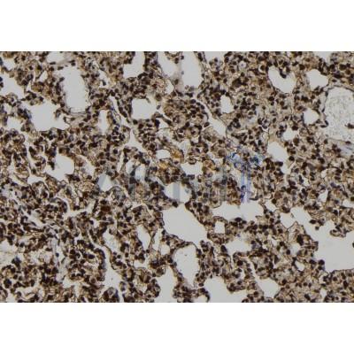 NEB2 Antibody - DF10075 at 1/100 staining Rat lung tissue by IHC-P.