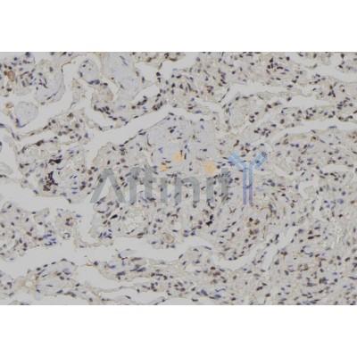 CSNK1G3 Antibody - DF10135 at 1/100 staining Human lung tissue by IHC-P.