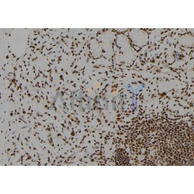 DYRK2 Antibody - DF10136 at 1/100 staining Human gastric tissue by IHC-P.