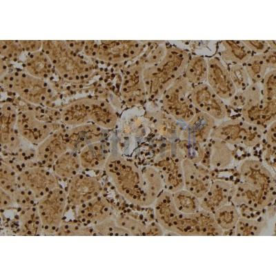 FUBP1 Antibody - DF2924 at 1/100 staining Rat kidney tissue by IHC-P.