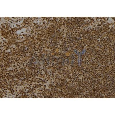 Phospho-RSK1 p90 (Thr359+Ser363) Antibody - DF2949 at 1/100 staining Human spleen tissue by IHC-P.