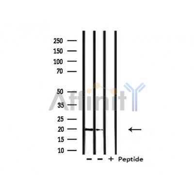 hCG beta Antibody - Western blot analysis of extracts from rat liver, rat brain, using hCG beta Antibody.