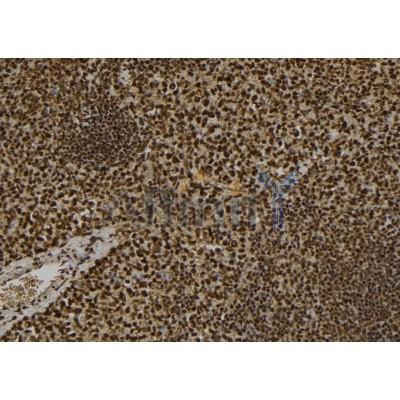 PKC alpha Antibody - DF2952 at 1/100 staining Mouse spleen tissue by IHC-P.