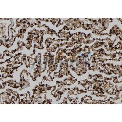 TP53I11 Antibody - DF3009 at 1/100 staining Human lung tissue by IHC-P.