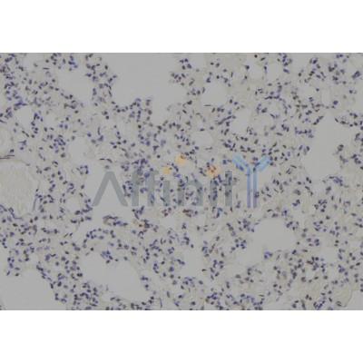 MDM4 Antibody - DF7532 at 1/100 staining Rat lung tissue by IHC-P.