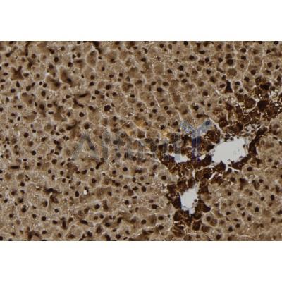 DDX3 Antibody - DF7537 at 1/100 staining Rat liver tissue by IHC-P.