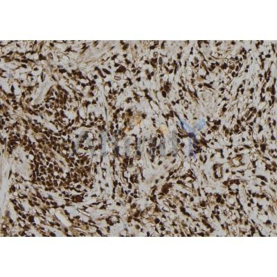 Parvalbumin Antibody - DF7544 at 1/100 staining Human gastric tissue by IHC-P.