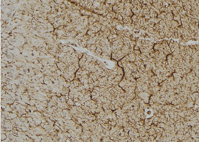 AIF1/IBA1 Antibody - DF7552 at 1/100 staining rat brain tissue by IHC-P.
