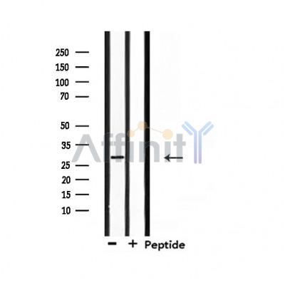 RNF144A Antibody - Western blot analysis of extracts from mouse lung, using RNF144A Antibody.