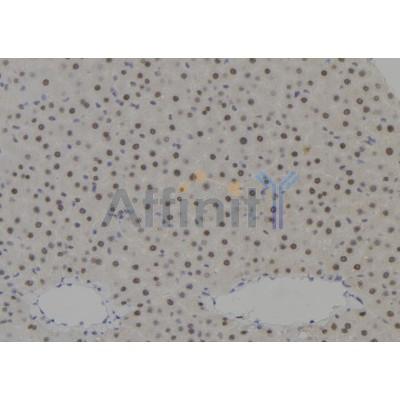 MSH6 Antibody - DF7566 at 1/100 staining Human liver tissue by IHC-P.