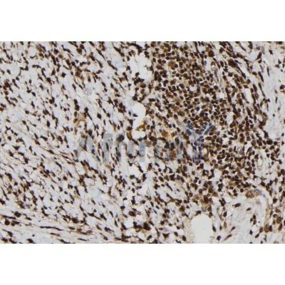 Calretinin Antibody - DF7586 at 1/100 staining Human gastric tissue by IHC-P.