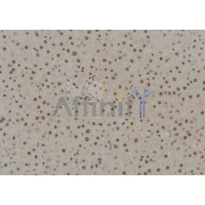 PAX6 Antibody - DF7605 at 1/100 staining Rat liver tissue by IHC-P.