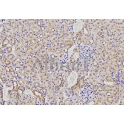 AMFR Antibody - DF7718 at 1/100 staining Rat kidney tissue by IHC-P.