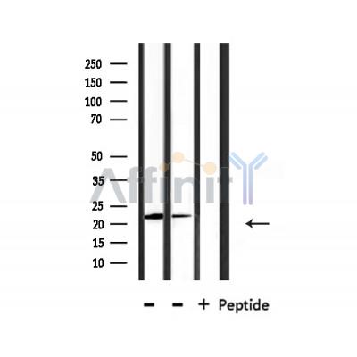 DIRA1 Antibody - Western blot analysis of extracts from mouse spleen, HepG2, using DIRA1 Antibody.