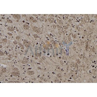 TFAP2C Antibody - DF7776 at 1/100 staining Rat brain tissue by IHC-P.