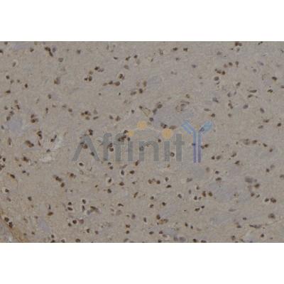 Cytokeratin 6a Antibody - DF7789 at 1/100 staining Rat brain tissue by IHC-P.