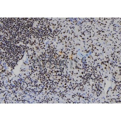 RBBP7 Antibody - DF8024 at 1/100 staining Human spleen tissue by IHC-P.