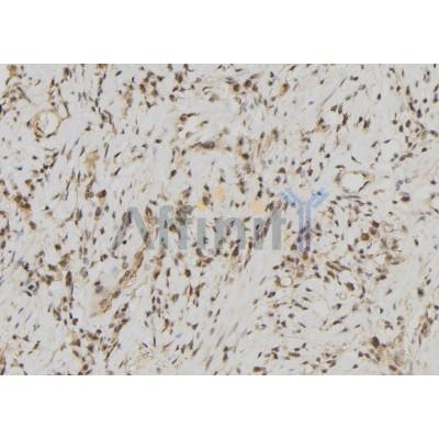 FDPS Antibody - DF8118 at 1/100 staining Human gastric tissue by IHC-P.