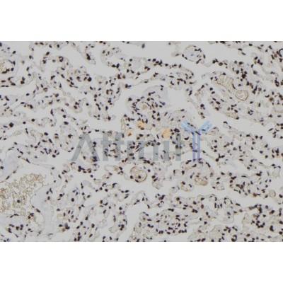 XPO4 Antibody - DF8190 at 1/100 staining Human lung tissue by IHC-P.