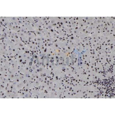 SOX1 Antibody - DF8196 at 1/100 staining Human liver tissue by IHC-P.