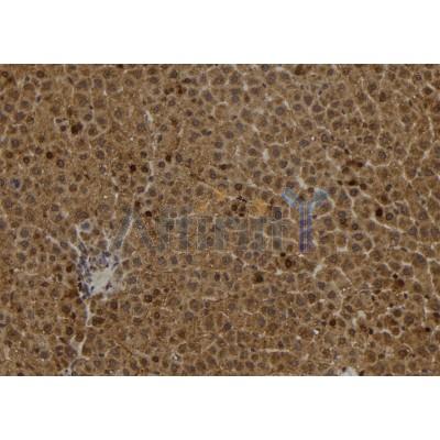 S100A2 Antibody - DF8225 at 1/100 staining Rat liver tissue by IHC-P.