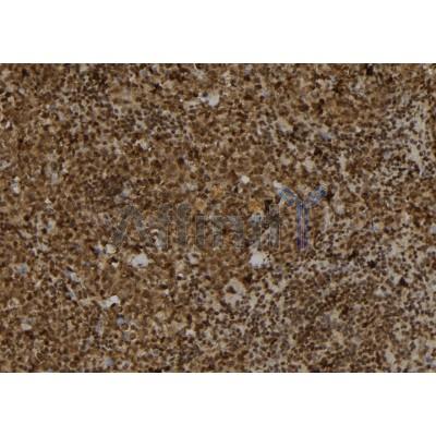 TRAM2 Antibody - DF8241 at 1/100 staining Mouse spleen tissue by IHC-P.