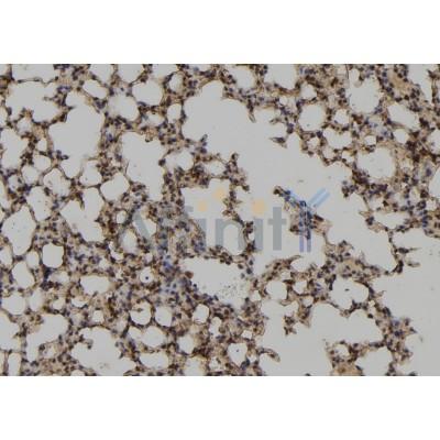 UBE2M Antibody - DF8243 at 1/100 staining Mouse lung tissue by IHC-P.