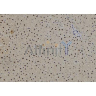 NR2E1 Antibody - DF8295 at 1/100 staining Rat liver tissue by IHC-P.