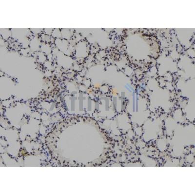 PKP3 Antibody - DF8310 at 1/100 staining Mouse lung tissue by IHC-P.