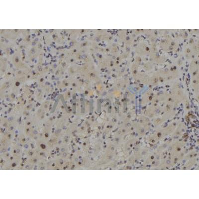 COPS7B Antibody - DF8376 at 1/100 staining Human liver tissue by IHC-P.