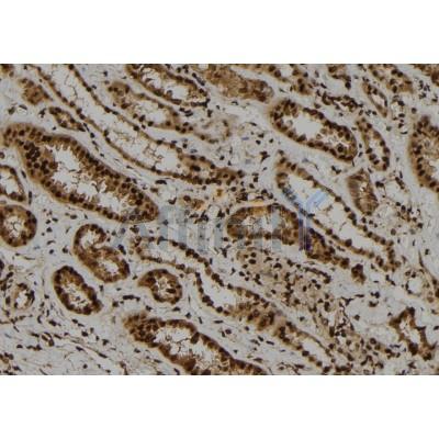 ARL4A Antibody - DF8378 at 1/100 staining Human kidney tissue by IHC-P.