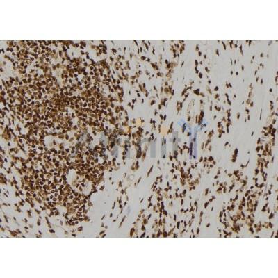 ASCL1 Antibody - DF8504 at 1/100 staining Human gastric tissue by IHC-P.