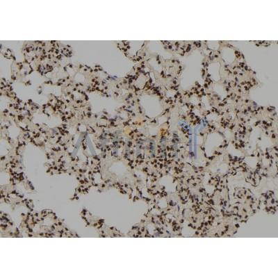 RFC3 Antibody - DF8600 at 1/100 staining Rat lung tissue by IHC-P.