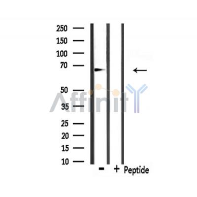 Involucrin Antibody - Western blot analysis of extracts from 293, using Involucrin Antibody.