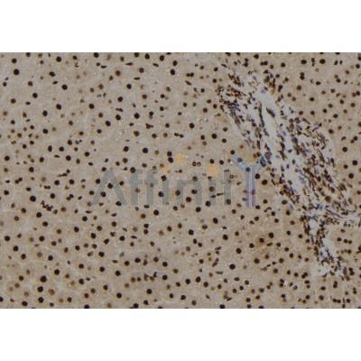 Histone H2B Antibody - DF8666 at 1/100 staining Rat liver tissue by IHC-P.