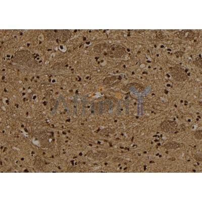 TBX15/18 Antibody - DF8727 at 1/100 staining Rat brain tissue by IHC-P.
